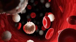 La leucemia es un cáncer que se origina en las células que normalmente madurarían hacia las células sanguíneas.&nbsp;