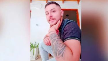 Murió un argentino que contrajo viruela del mono en México