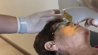 Tratamiento contra el ojo seco.