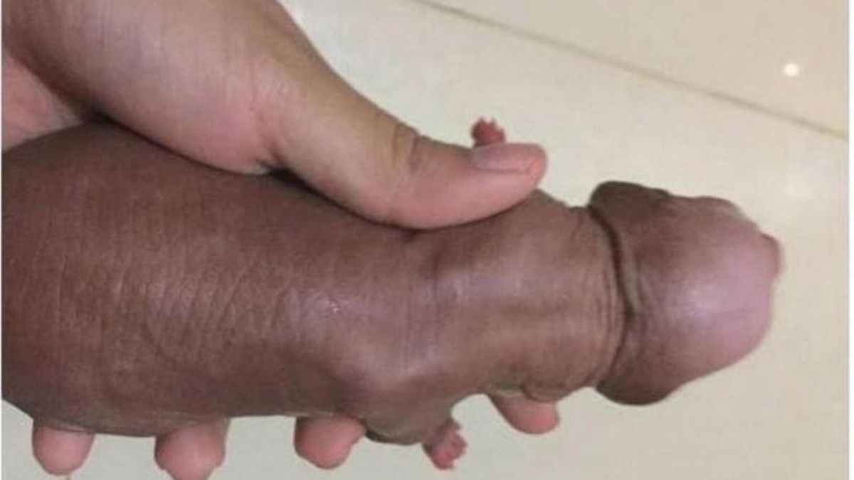 Subió una foto de su cachorro y lo denunciaron pensando que era un pene