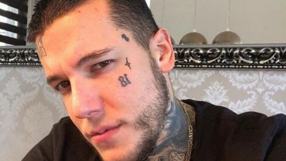 Así le quedó la cara a Alexander Caniggia tras su operación de nariz