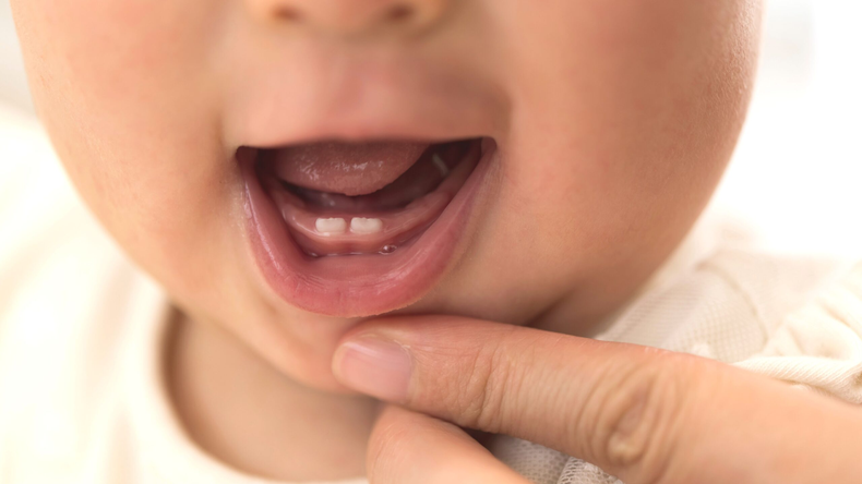 Dientes de leche.