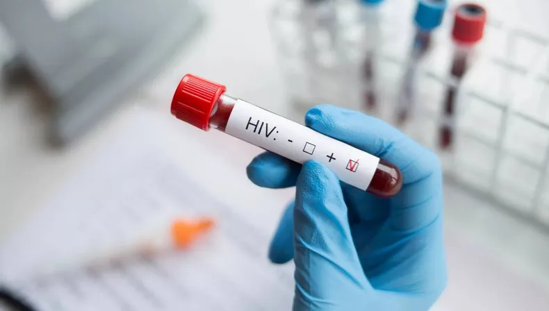 El último informe del Ministerio de Salud  de la Argentina reveló que el 98% de las personas que contrajeron VIH lo hicieron a través de relaciones sexuales sin preservativo.