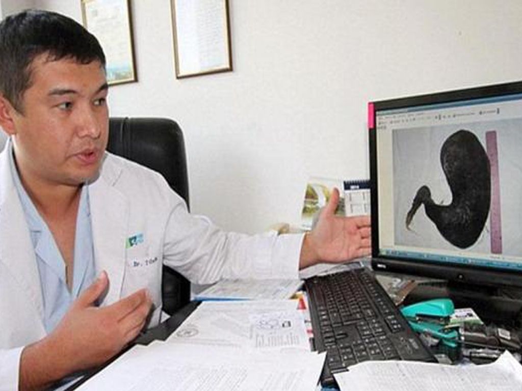 No hubo un caso similar en 50 años