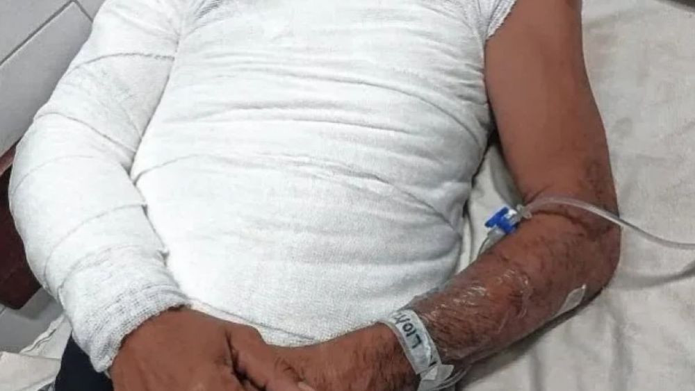 Pelea por un sachet de mayonesa termina con un herido en el hospital.