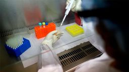 Qué es la Legionella, el brote que estaría detrás de las muertes en Tucumán.&nbsp;