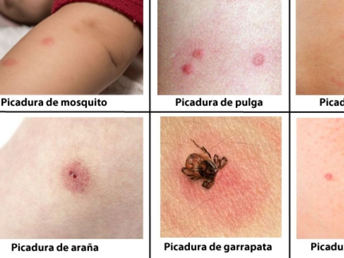 Pulgas Y Garrapatas Visitantes De Todo El Ano