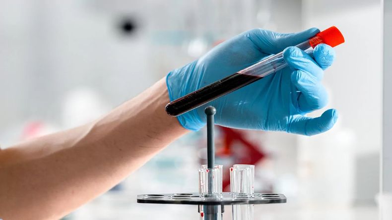 La&nbsp;sangre menstrual&nbsp;en los sueños también se puede relacionar con los&nbsp;ciclos.&nbsp;