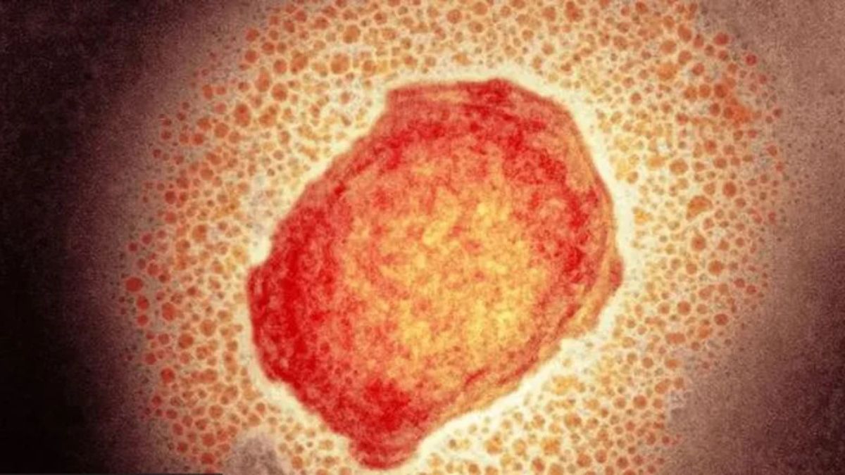 Mas de 200 casos a nivel mundial de la viruela del mono tienen lugar en la actualidad, sin considerar los casos de los países donde la enfermedad es endémica.
