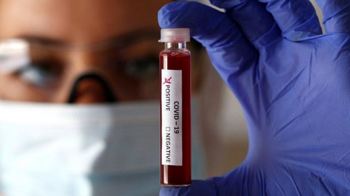 Todo Jujuy | Casos de coronavirus en Jujuy.jpg