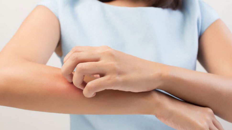 Revelaron cómo los mosquitos eligen a sus víctimas y por qué pican más a algunas personas