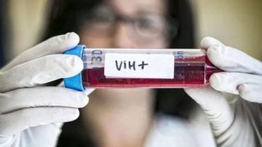 La variante bautizada VB es particularmente agresiva y triplica o incluso quintuplica la cantidad habitual de virus en la sangre.