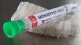 Viruela del Mono: se confirmó el primer caso en Argentina