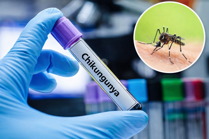 Diferencias y riesgos del chikungunya
