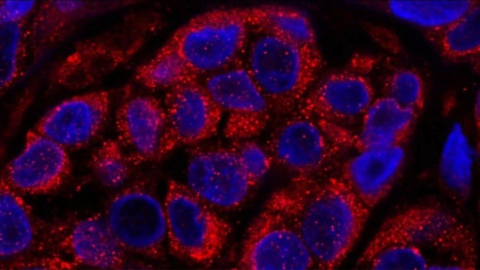 Descubren el origen de la metástasis y comienzan a investigar posibles tratamientos