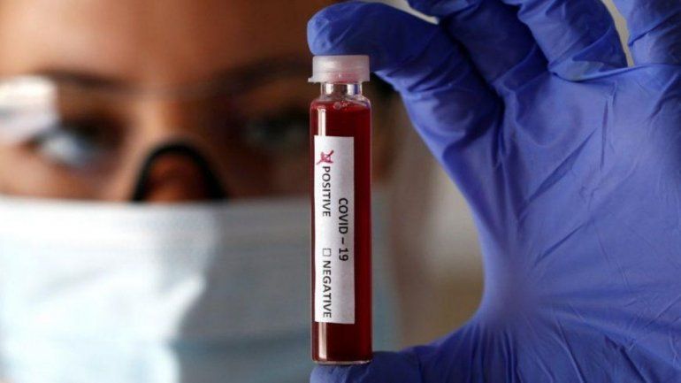 Casos de coronavirus en Jujuy