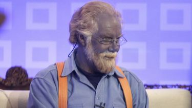 La extraña condición médica que sufrió Paul Karason, conocido como “Papá Pitufo” que tiñó todo su cuerpo de color azul.