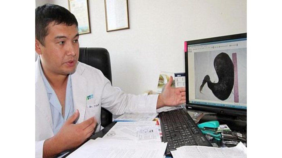No hubo un caso similar en 50 años