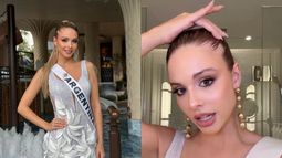 La Miss Universo Argentina reveló una afección que sufre La Miss Universo Argentina reveló una afección que sufre